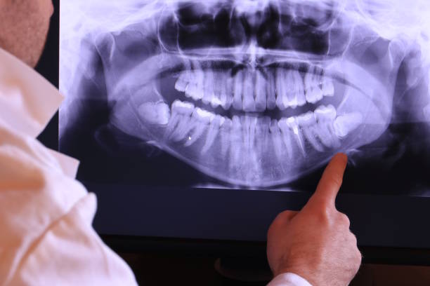 Best Dentist for Tooth Abscess  in Gooding, ID